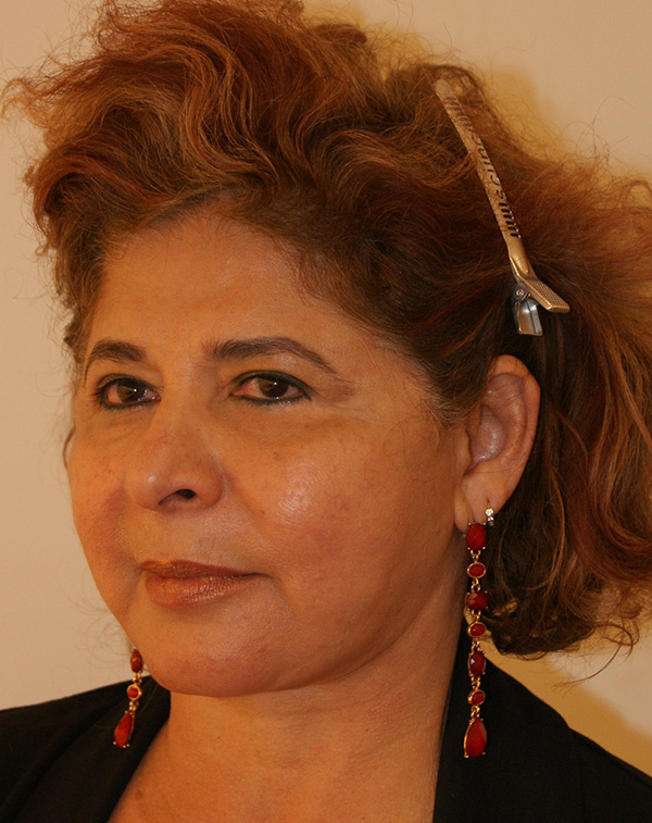 Photo of Patient 08 After Face And Neck Lift Procedure