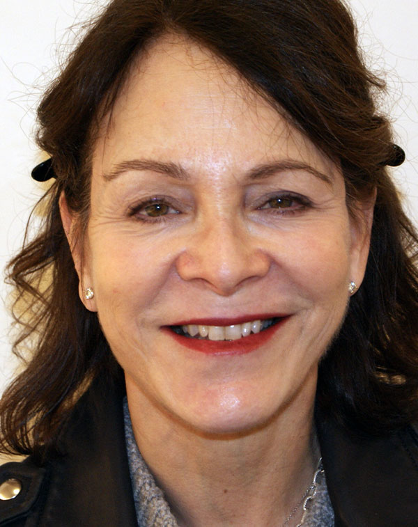 Photo of Patient 24 After Face And Neck Lift Procedure