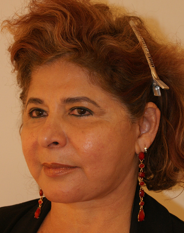 Photo of Patient 31 After Face And Neck Lift Procedure