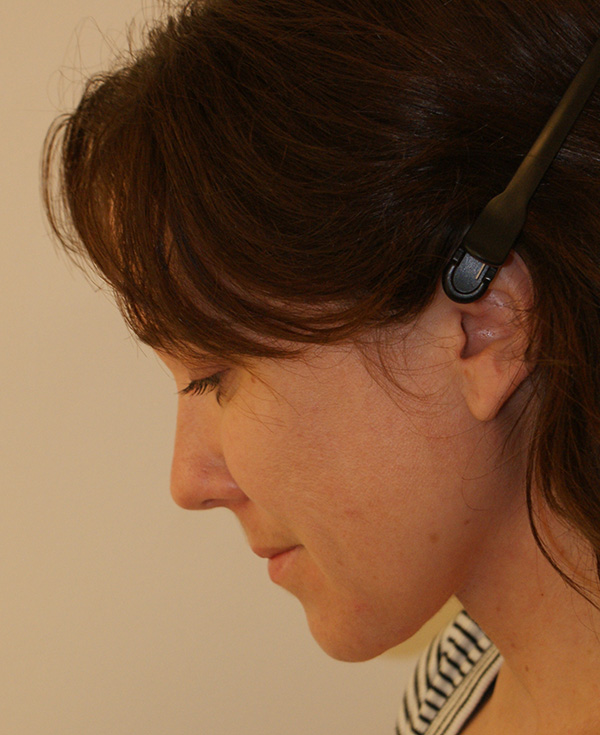 Photo of Patient 23 After Nose Procedure