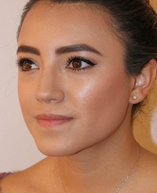 Photo of Patient 44 After Nose Procedure